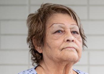 Photo is of an elderly woman with short brown hair streaked with blonde.